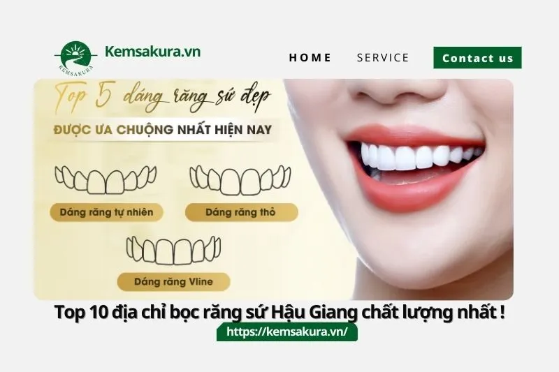 Top 10 địa chỉ bọc răng sứ Hậu Giang chất lượng nhất !